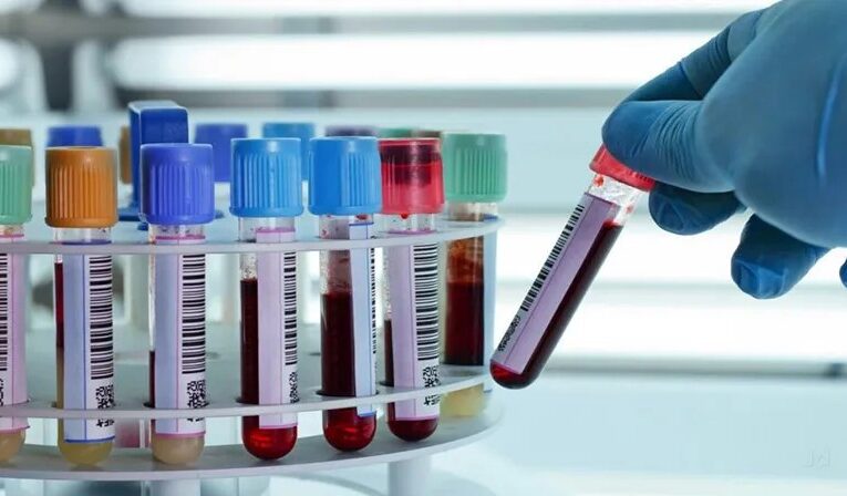 AYUSH Drug Testing Laboratory in Sontyam Still Non-Functional Over 10 Months After Completion