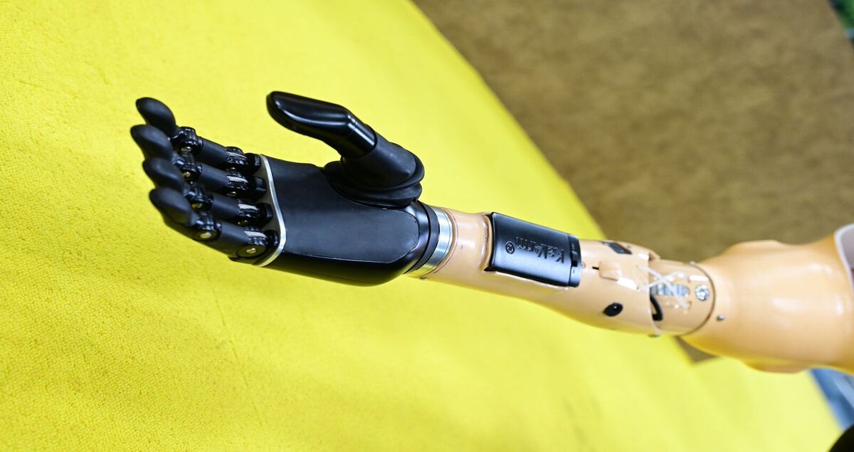 Visakhapatnam emerges as a hub for advanced prosthetic solutions