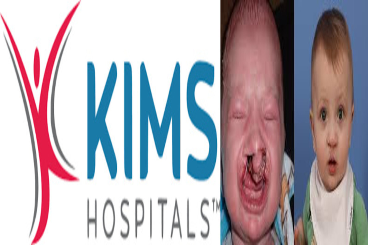 Early surgery key to preventing lifelong impact of cleft conditions