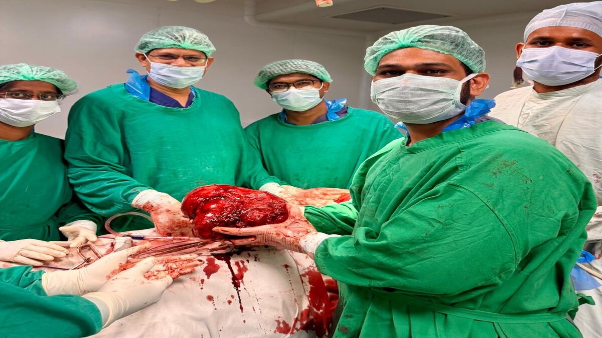 KGH surgeons remove 4.5-kg adrenal tumours in rare high-risk surgery