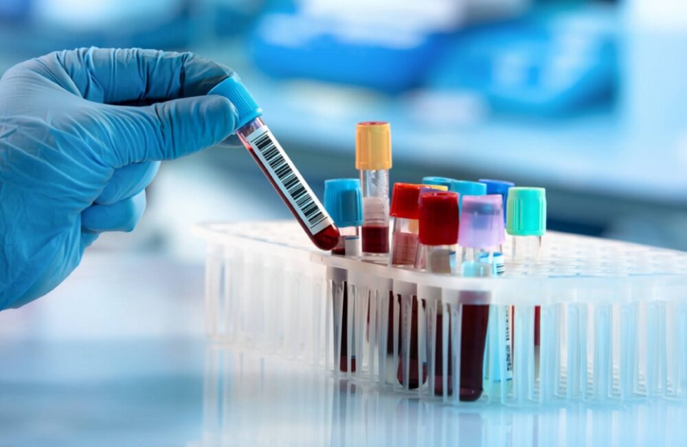 Unauthorised diagnostic centres thrive in Anakapalli