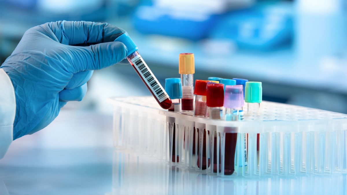 Unauthorised diagnostic centres thrive in Anakapalli