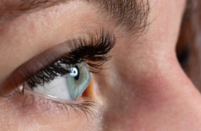 Frequent changes in eye power could signal keratoconus: LVPEI doctors