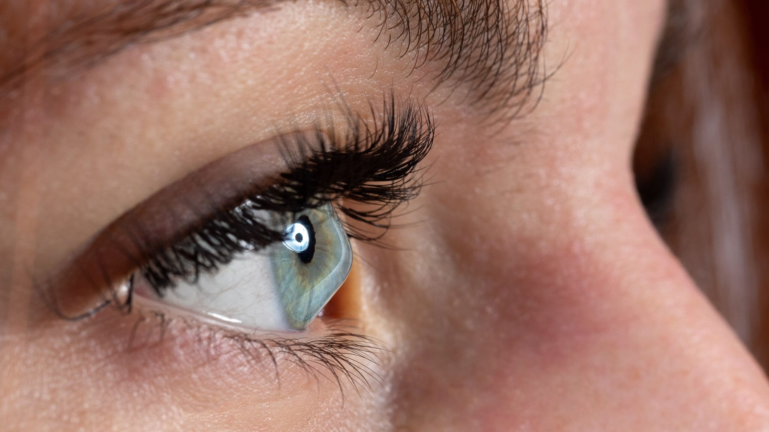 Frequent changes in eye power could signal keratoconus: LVPEI doctors